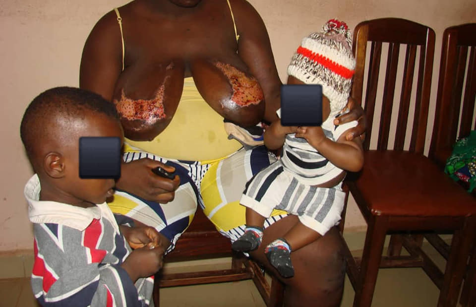 Man poured hot water on wife while breastfeeding in Enugu (photos)